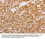 STK40 Antibody