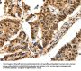 SSB Antibody