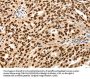 SSB Antibody