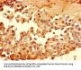 MUC1 Antibody