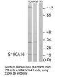 S100A16 Antibody