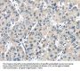TRPM2 Antibody