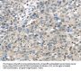 TRPM2 Antibody