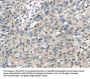 TRPM2 Antibody