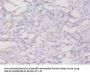 FTL Antibody