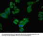 FTL Antibody