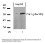 Phospho-CHEK1 (Ser280) Antibody