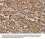 ACHE Antibody
