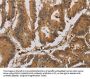 ACHE Antibody