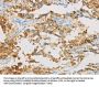 Rabbit anti-human IDH3B polyclonal antibody