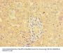 CTSL Antibody