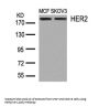 ERBB2 (Ab-1248) Antibody