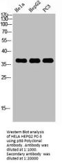MAPK14 Antibody
