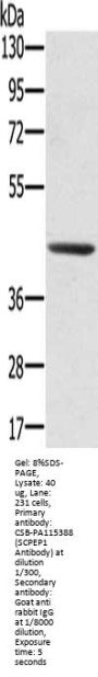 Rabbit anti-human SCPEP1 polyclonal antibody