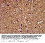 FHIT Antibody