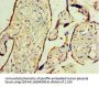 WT1 Antibody