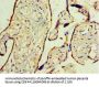 WT1 Antibody