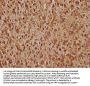 MDM2 Antibody