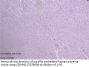 ABCB1 Antibody