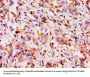 ABCB1 Antibody