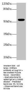 CHRNA1 Antibody