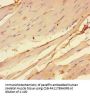 CHRNA1 Antibody