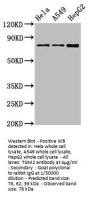 TGM2 Antibody