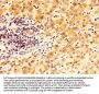 TGM2 Antibody