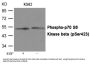 Phospho-RPS6KB2 (Ser423) Antibody