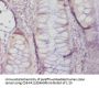 MGMT Antibody
