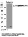 Phospho-EGFR (Ser1071) Antibody