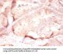 COL4A2 Antibody