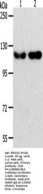 ABL2 Antibody
