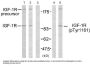 Phospho-IGF1R (Tyr1161) Antibody