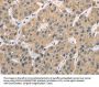 TRIB3 Antibody