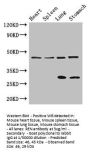 REN Antibody