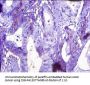 TTR Antibody