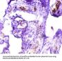ICA1 Antibody