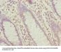 HABP2 Antibody