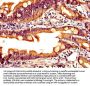 PYY Antibody