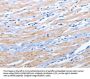 Rabbit anti-human EPHA1 polyclonal antibody