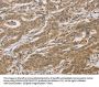 CYFIP2 Antibody