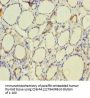 TPO Antibody