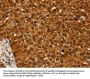RAN Antibody