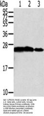 RAN Antibody