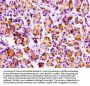 PRSS3 Antibody
