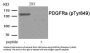 Phospho-PDGFRA (Tyr849) Antibody