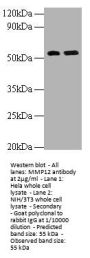 Rabbit anti-human Macrophage metalloelastase polyclonal Antibody
