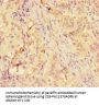 Rabbit anti-human Macrophage metalloelastase polyclonal Antibody