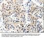 APP Antibody